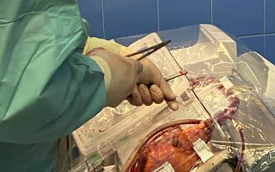 Transplantácia srdca